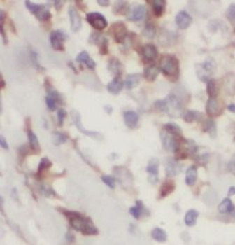KRAS Antibody