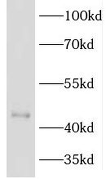 KRR1 Rabbit Polyclonal Antibody