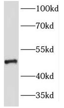 KRT23 Rabbit Polyclonal Antibody