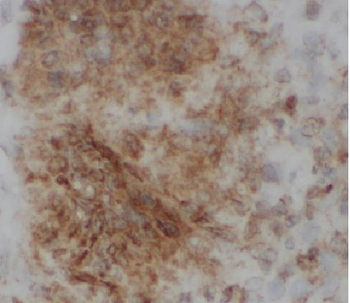 KRT23 Rabbit Polyclonal Antibody