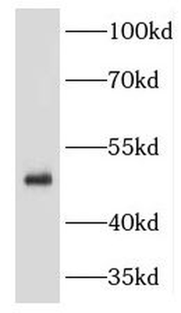 KRT34 Rabbit Polyclonal Antibody