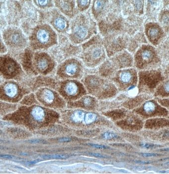 KRT34 Rabbit Polyclonal Antibody