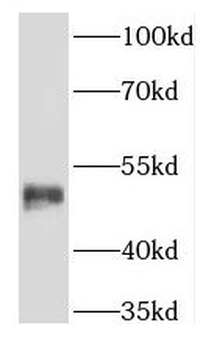 KRT36 Rabbit Polyclonal Antibody