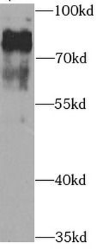 KCND2 Rabbit Polyclonal Antibody