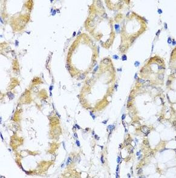 KCND2 Rabbit Polyclonal Antibody