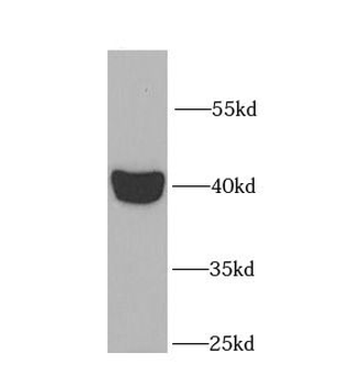 L2HGDH Rabbit Polyclonal Antibody