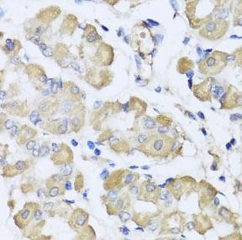 L2HGDH Rabbit Polyclonal Antibody