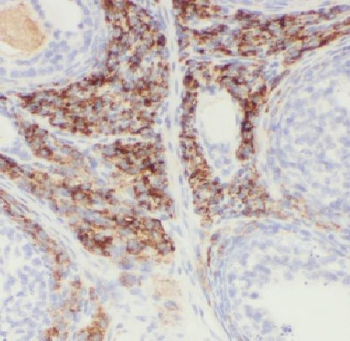 LAMA4 Rabbit Polyclonal Antibody