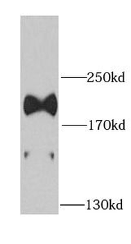 LAMB1 Rabbit Polyclonal Antibody