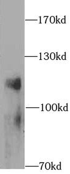 LAMP1 Antibody