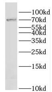 LAMP3 Rabbit Polyclonal Antibody