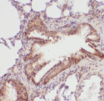 LAMP3 Rabbit Polyclonal Antibody