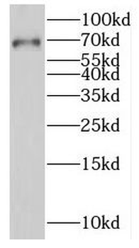 LARP7 Rabbit Polyclonal Antibody