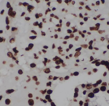 LARP7 Rabbit Polyclonal Antibody