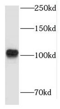 LARS2 Rabbit Polyclonal Antibody