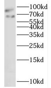LAS1L Rabbit Polyclonal Antibody