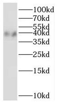 LASP1 Rabbit Polyclonal Antibody