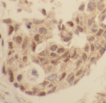 LASP1 Rabbit Polyclonal Antibody