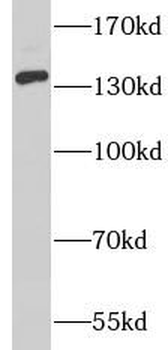 LATS1 Rabbit Polyclonal Antibody