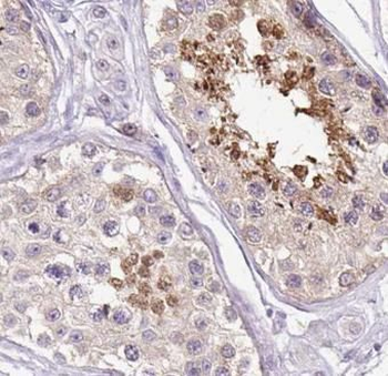 LATS1 Rabbit Polyclonal Antibody
