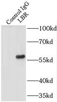 LBR Antibody