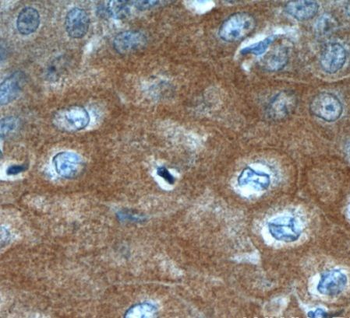 LCE1A Rabbit Polyclonal Antibody