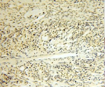 LDB1 Rabbit Polyclonal Antibody