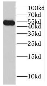 LDHD Rabbit Polyclonal Antibody