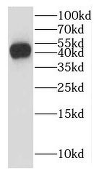 LEF1 Rabbit Polyclonal Antibody