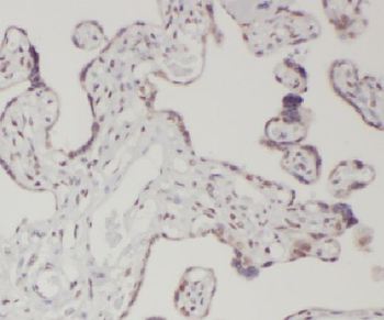 LETM2 Rabbit Polyclonal Antibody