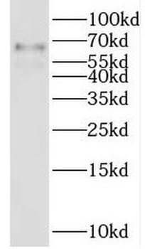 LGI1 Antibody