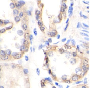 LGI1 Antibody
