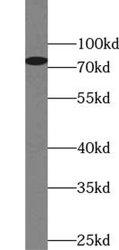 DHX58 Rabbit Polyclonal Antibody