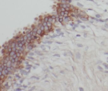 DHX58 Rabbit Polyclonal Antibody