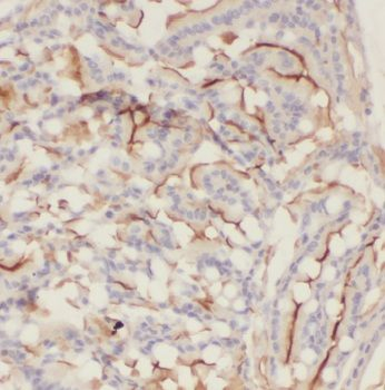 LGR4 Rabbit Polyclonal Antibody