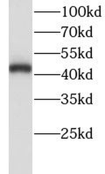 LHX5 Rabbit Polyclonal Antibody
