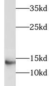 LIMD2 Rabbit Polyclonal Antibody