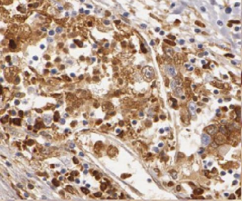 LIMD2 Rabbit Polyclonal Antibody