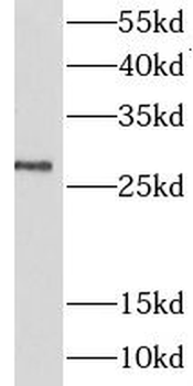 LIN28B Rabbit Polyclonal Antibody