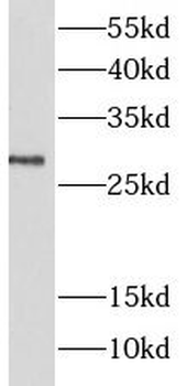 LIN7A Rabbit Polyclonal Antibody