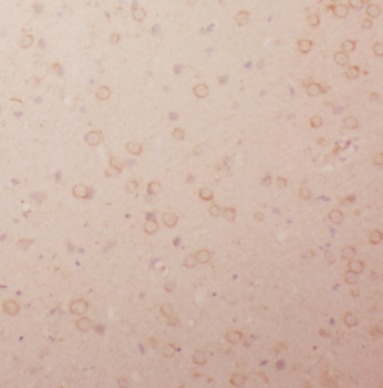 LIN7A Rabbit Polyclonal Antibody