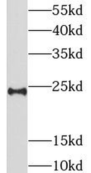 LIN7B Rabbit Polyclonal Antibody