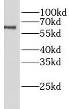 LIPC Rabbit Polyclonal Antibody