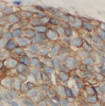LIPC Rabbit Polyclonal Antibody