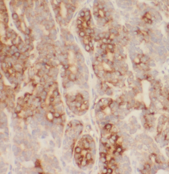 LMF1 Rabbit Polyclonal Antibody