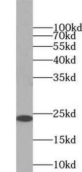 PSMB8 Rabbit Polyclonal Antibody