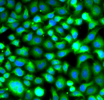 PSMB8 Rabbit Polyclonal Antibody