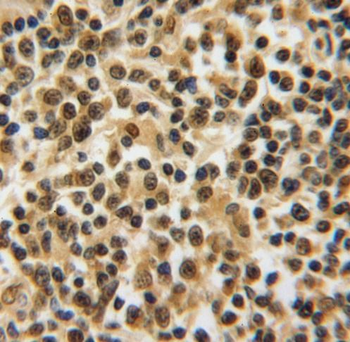 PSMB8 Rabbit Polyclonal Antibody