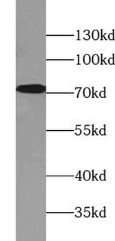 LNX1 Rabbit Polyclonal Antibody