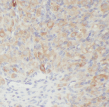 LPAR4 Rabbit Polyclonal Antibody